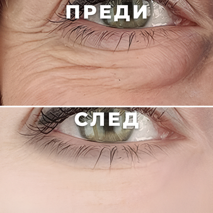 Корейски околоочен крем с PDRN, пептиди и 5% ниацинамид – с масажна ролка