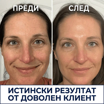 Корейски крем против бръчки за жени
