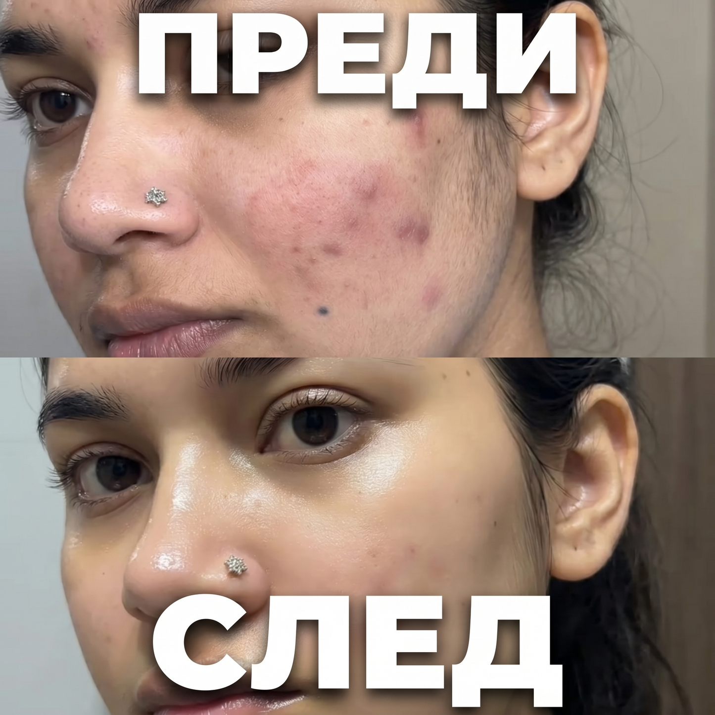 Pdrn серум 30мл